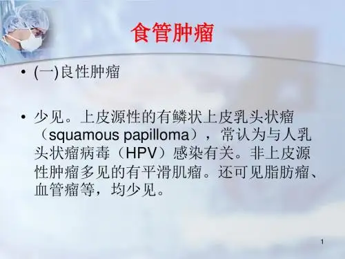 食管鳞状细胞癌医学PPT课件