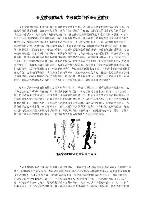 骨盆前倾的危害 专家谈如何矫正骨盆前倾