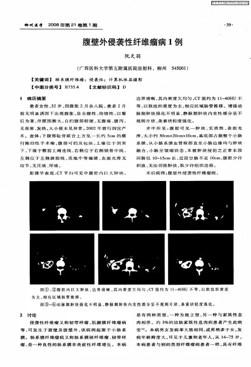 腹壁外侵袭性纤维瘤病1例