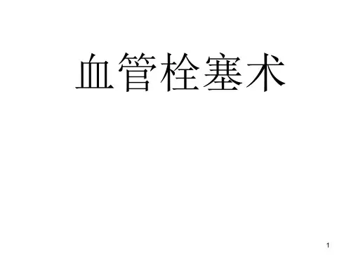 血管栓塞术PPT课件