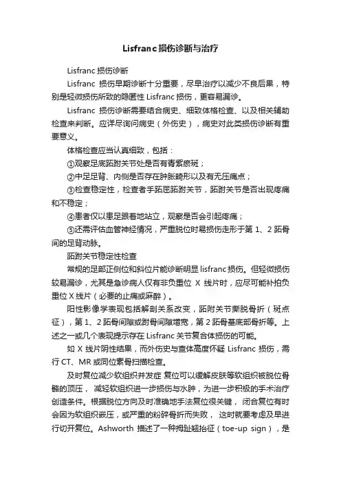 Lisfranc损伤诊断与治疗