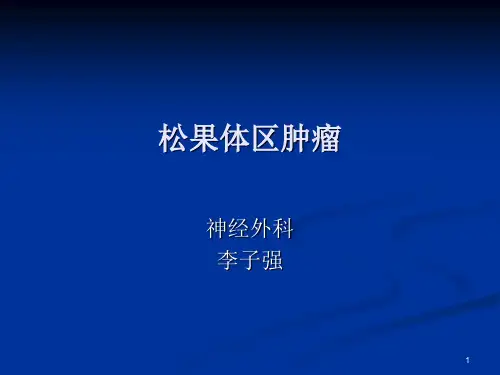 (参考课件)松果体区肿瘤