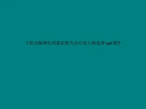 下肢动脉硬化闭塞症腔内治疗的入路选择 ppt课件