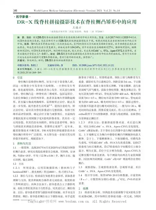 DR-X 线脊柱拼接摄影技术在脊柱侧凸矫形中的应用