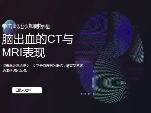 脑出血的影像学表现