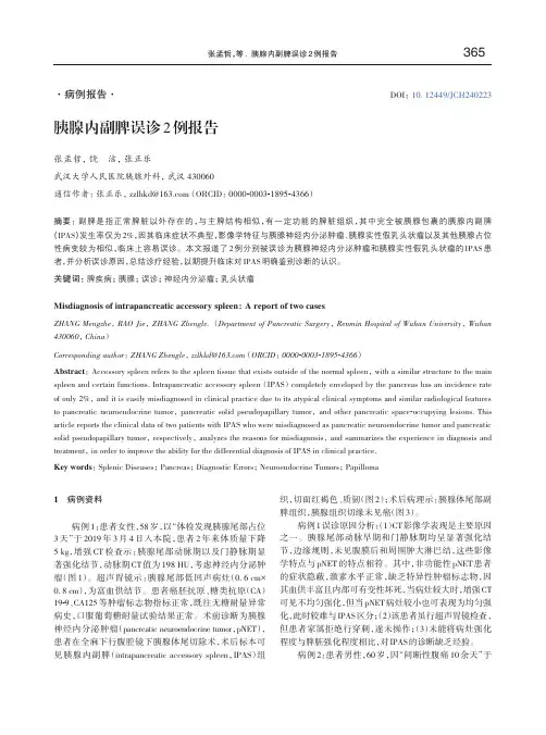 胰腺内副脾误诊2例报告