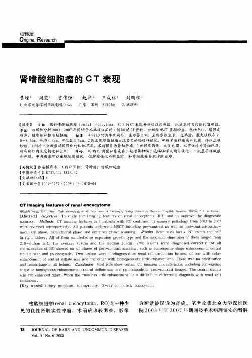 肾嗜酸细胞瘤的CT表现