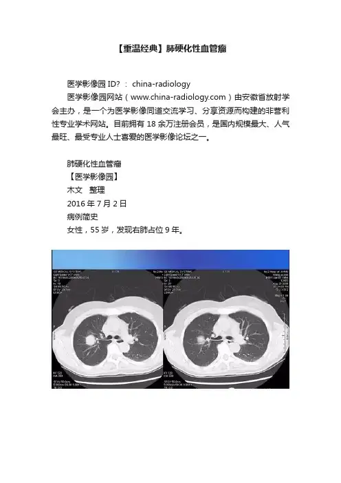 【重温经典】肺硬化性血管瘤