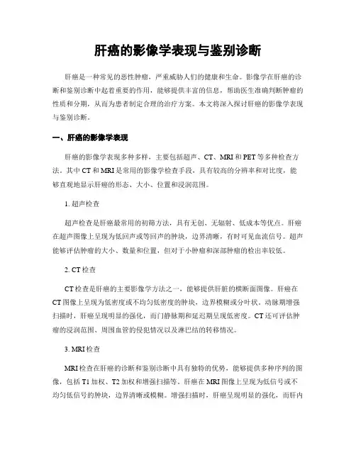 肝癌的影像学表现与鉴别诊断
