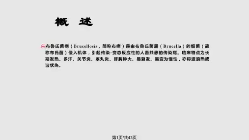 布病的预防与控制PPT课件