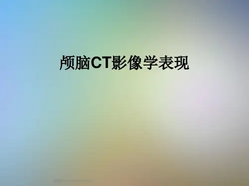 颅脑CT影像学表现
