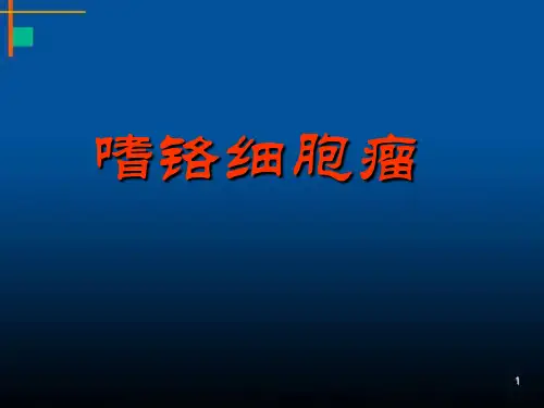嗜铬细胞瘤幻灯PPT课件