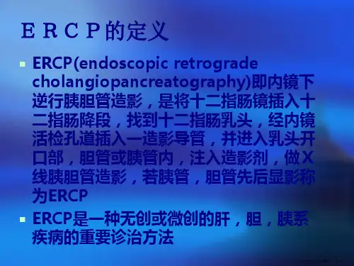ERCP的临床应用(附病例)