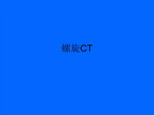 第五节螺旋CT