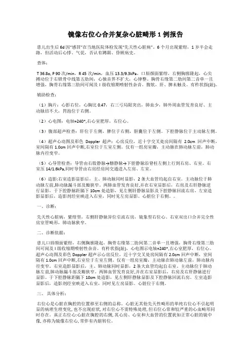 镜像右位心合并复杂心脏畸形1例报告