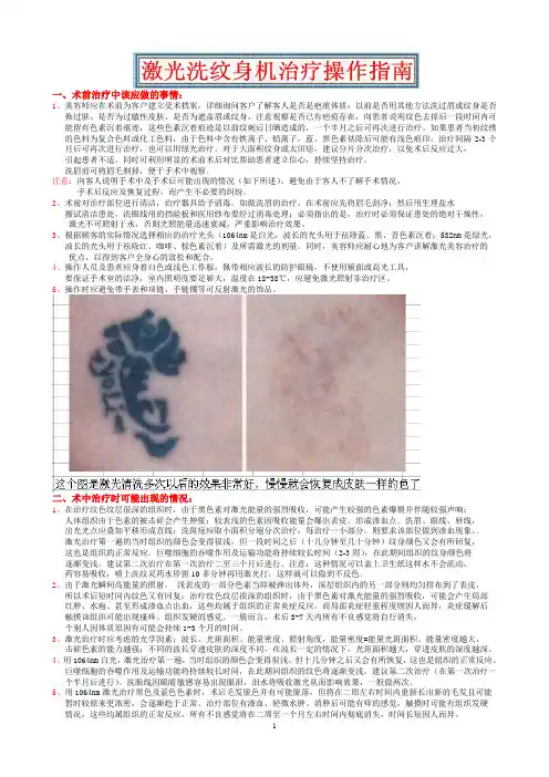 激光洗纹身操作指南
