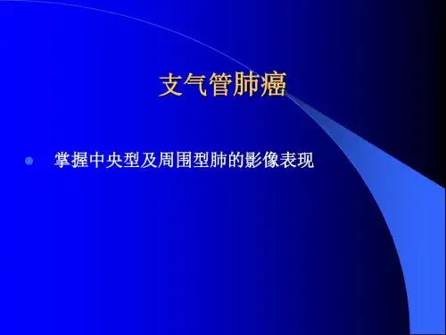 肺癌影像学表现ppt课件