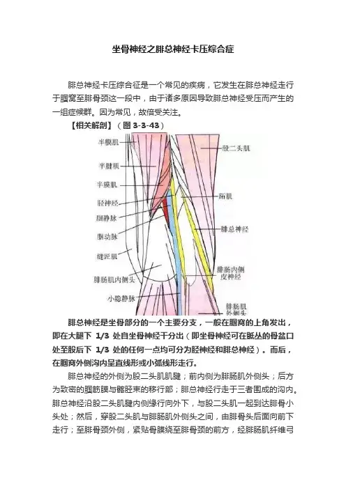 坐骨神经之腓总神经卡压综合症