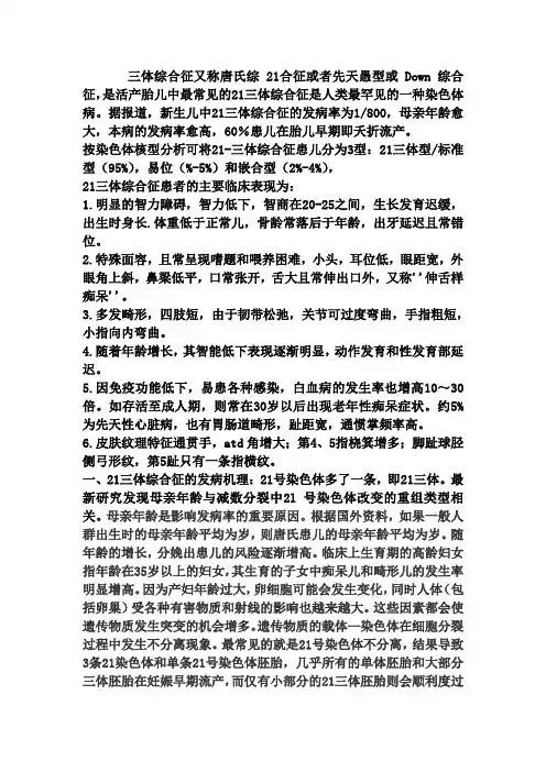关于21三体综合症的综述