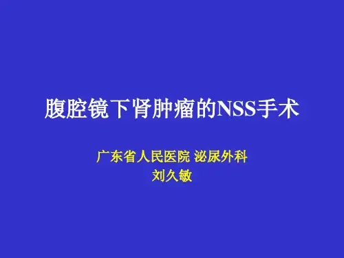 NSS