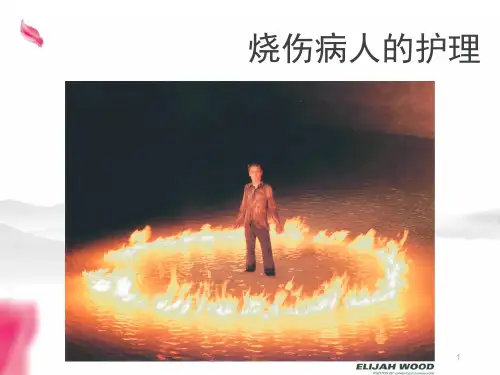 烧伤病人的护理ppt课件