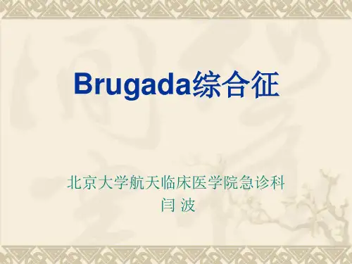 Brugada综合征