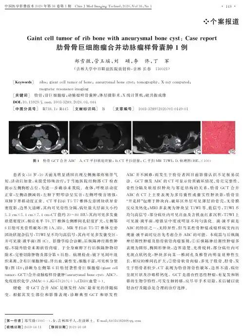 肋骨骨巨细胞瘤合并动脉瘤样骨囊肿1例