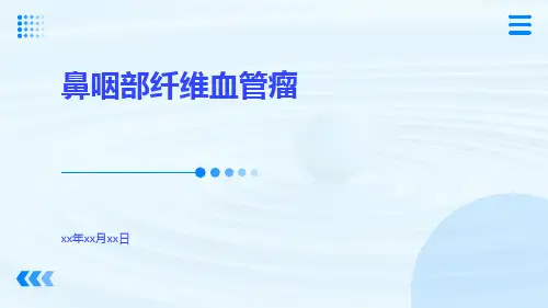 鼻咽部纤维血管瘤