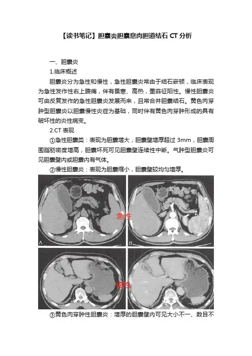 【读书笔记】胆囊炎胆囊息肉胆道结石CT分析