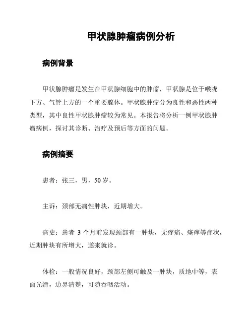 甲状腺肿瘤病例分析