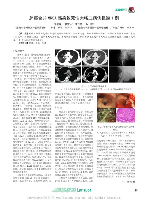 肺癌合并MRSA 感染致死性大咯血病例报道1 例