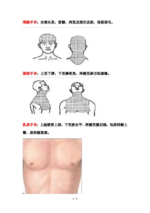 外科备皮范围