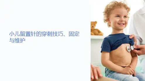 小儿留置针的穿刺技巧、固定与维护