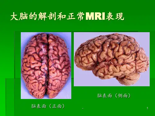 大脑的解剖和正常MRI表现ppt课件