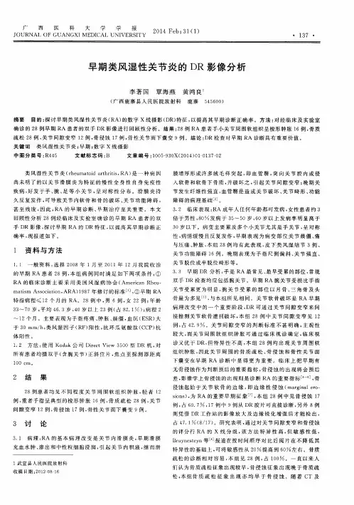 早期类风湿性关节炎的DR影像分析