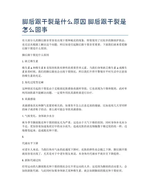脚后跟干裂是什么原因-脚后跟干裂是怎么回事