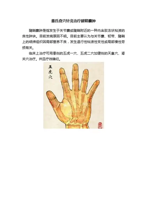 董氏奇穴针灸治疗腱鞘囊肿