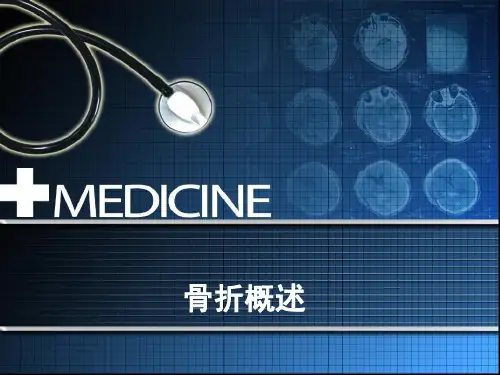 骨折概述  ppt课件