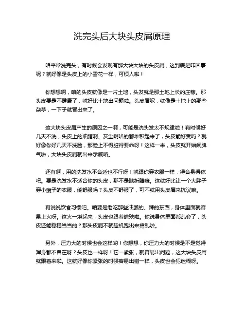 洗完头后大块头皮屑原理