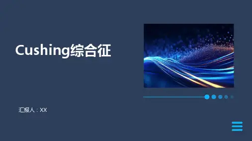Cushing综合征