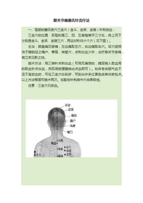 膝关节痛董氏针灸疗法