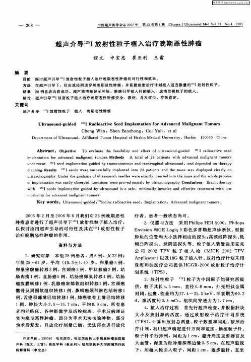 超声介导 125I放射性粒子植入治疗晚期恶性肿瘤