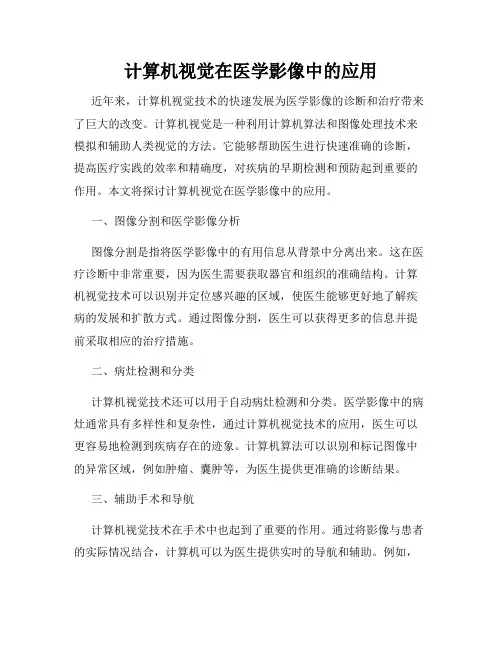 计算机视觉在医学影像中的应用