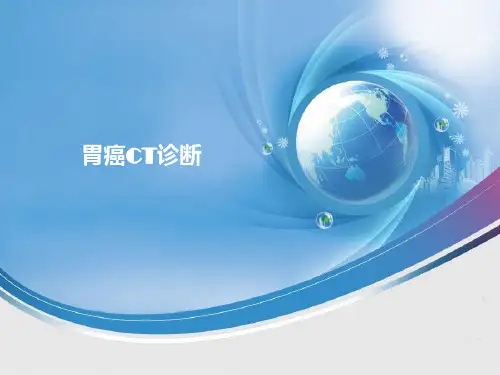 胃癌CT表现