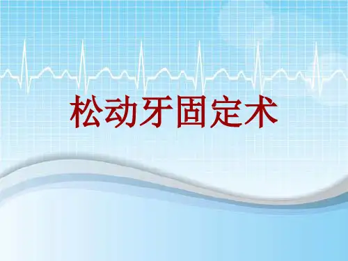 手术讲解模板：松动牙固定术
