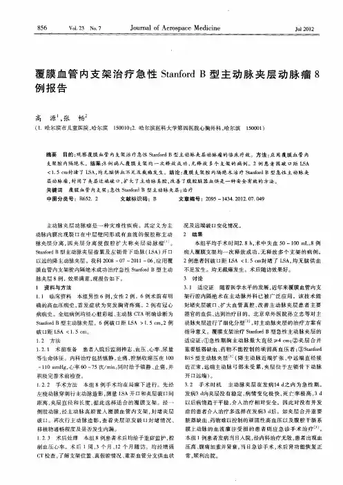 覆膜血管内支架治疗急性Stanford B型主动脉夹层动脉瘤8例报告