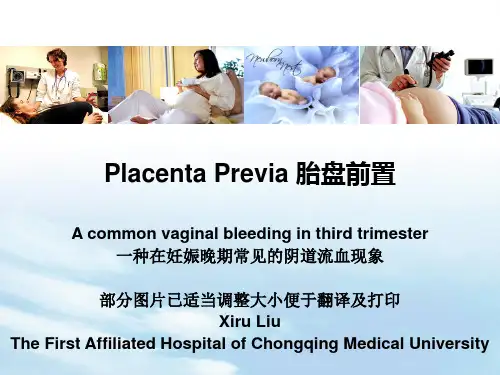 (妇产科学课件)8.3(参考翻译)Placenta Previa