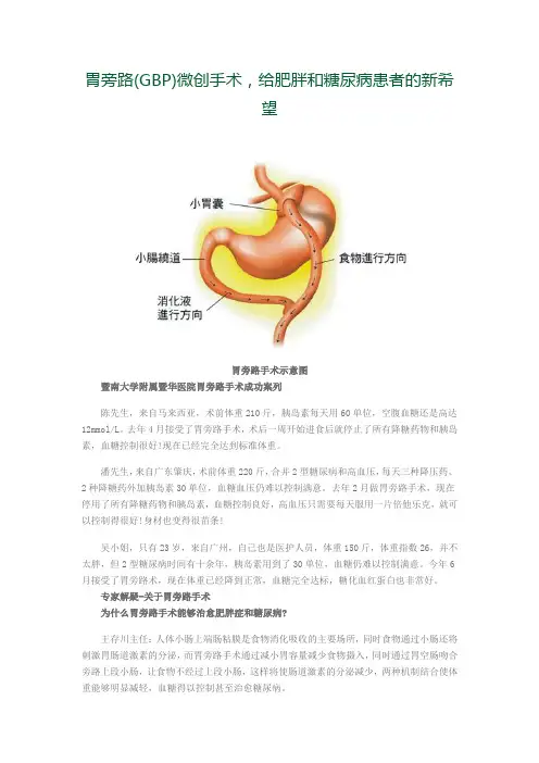 胃旁路(GBP)微创手术给肥胖和糖尿病患者的新希望