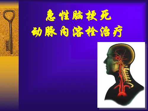 动脉溶栓