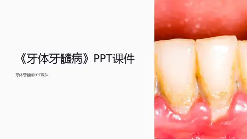 《牙体牙髓病》课件